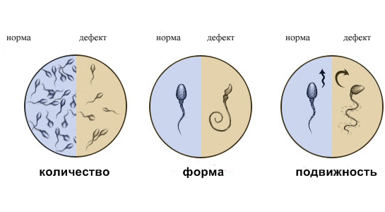 Сдача спермограммы и анализа эякулята, цены в Москве - ДНКОМ