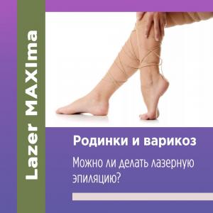 Фотография Lazer Maxima 4