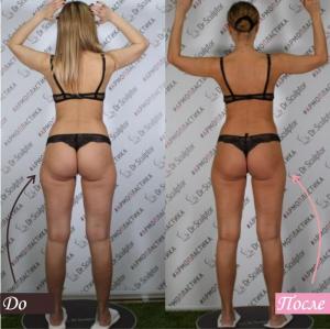 Фотография Dr. Sculptor 1