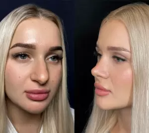 Фотография Софи Флёр 3